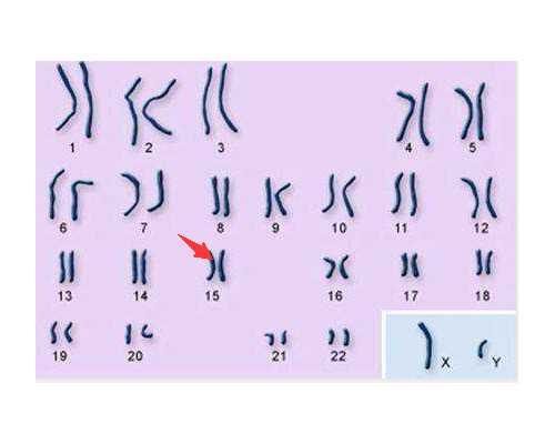 50万能找到助孕吗_aa69助孕地址,中心妇产的试管费用贵不贵？_孕中期脸色发粉生