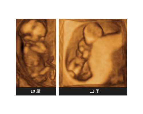 西安代生代生子网,西安妇幼医院试管婴儿花费_沈阳做三代试管婴儿要花多少钱