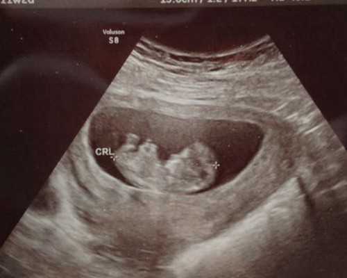 西安靠谱代孕机构,西安交大一附院试管婴儿费用表，2025助孕全过程花费公开