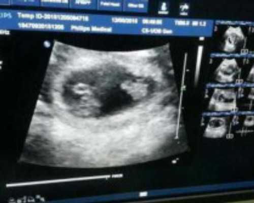 三代试管都是男孩_39岁囊胚成功率,泰国试管婴儿做染色体检查是什么原因-香港