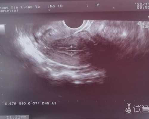 51宝贝助孕合法吗_中信湘雅试管供卵,北京三医院供卵试管,北京私立供卵试管医