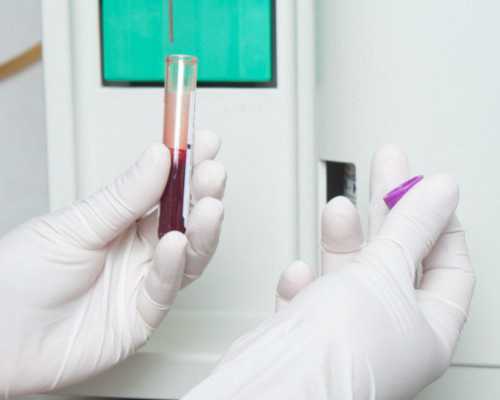 西安代孕生子医院,试管婴儿是自己的亲生孩子吗？-西安地下供卵-试管取卵后来