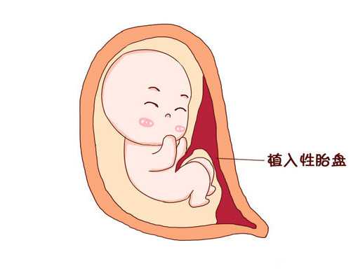 代怀双胞胎_合法代怀孕产子,安徽供卵代怀生子需要多少钱?附2024
安徽试管助孕