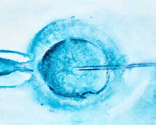 西安做供卵私立医院,西安三代试管婴儿生男孩_试管做男孩价格大概是多少?需