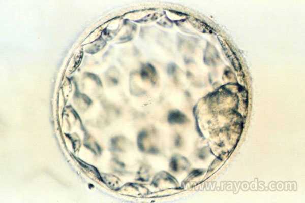 靠谱的供卵中心_金贝供卵口碑_囊胚培养，做试管婴儿我们是否需要养囊？